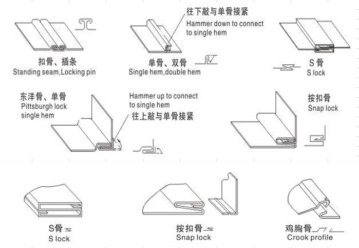 骨型